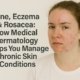 Acne, Eczema & Rosacea How Medical Dermatology Helps You Manage Chronic Skin Conditions