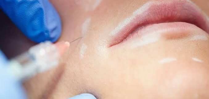 collagen stimulation