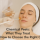 Chemical Peels